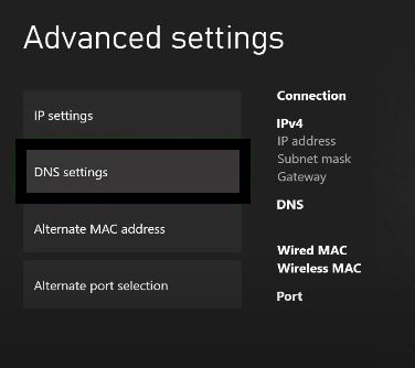 Xbox Series X/S Won't Connect To Wi-Fi